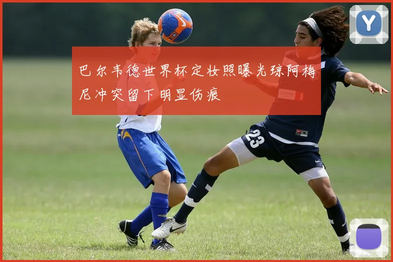 巴尔韦德世界杯定妆照曝光琼阿梅尼冲突留下明显伤痕